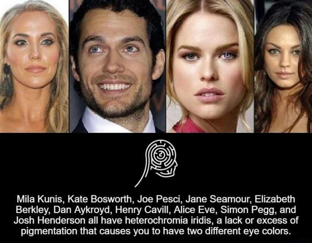 Mila Kunis Kate Bosworth Joe Pesci Jane Seamour Elizabeth Barkley Dan Aykroyd Henry Cavill Alice Eve Simon Pegg And Josh Henderson All Have Heterochromia Iridis A Lack Or Excess Of Pigmentation That