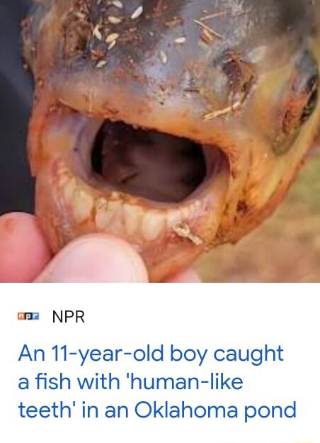 Pacu: Boy catches fish with 'human-like teeth' in an Oklahoma pond