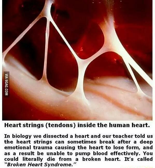 Heart strings (tendons) inside the human heart. In biology we dissected