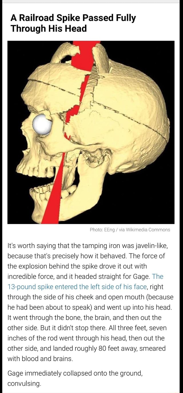 A Railroad Spike Passed Fully Through His Head Wikimedia Commons Its
