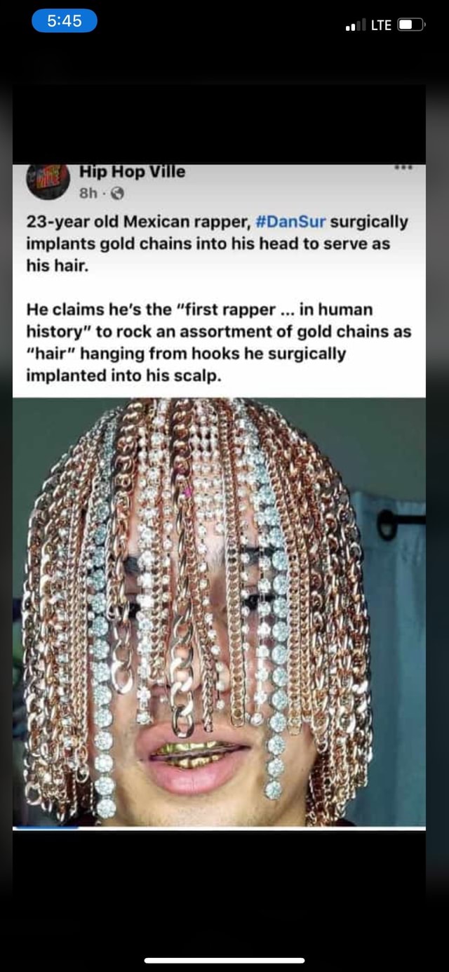 The rapper implanted gold chains instead of hair