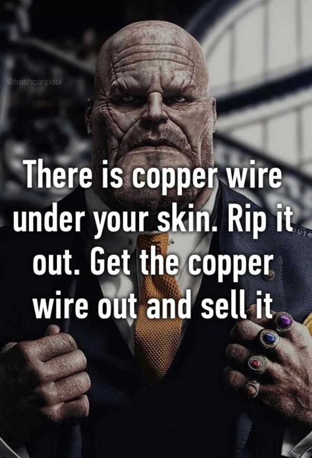 There is copper wire under your skin. Rip it out. Get the copper wire