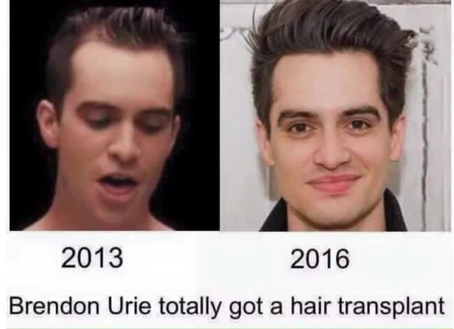 2013 2016 Brendon Urie totally got a hair transplant - iFunny