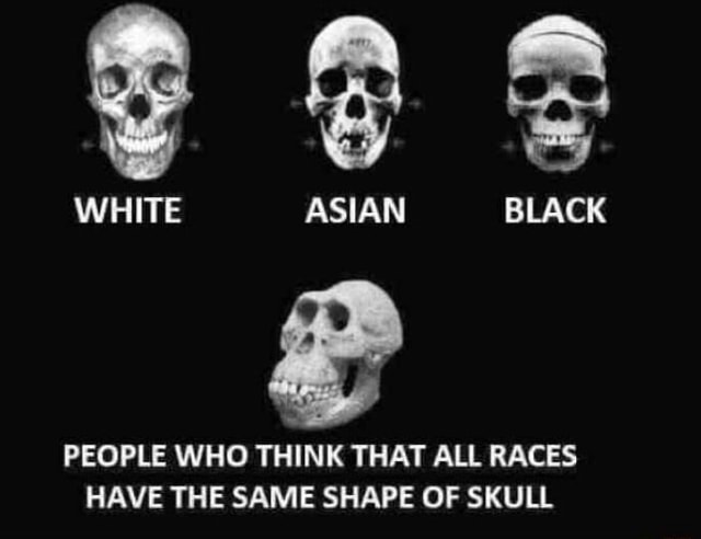 People Who Think That All Races Have The Same Shape Of Skull