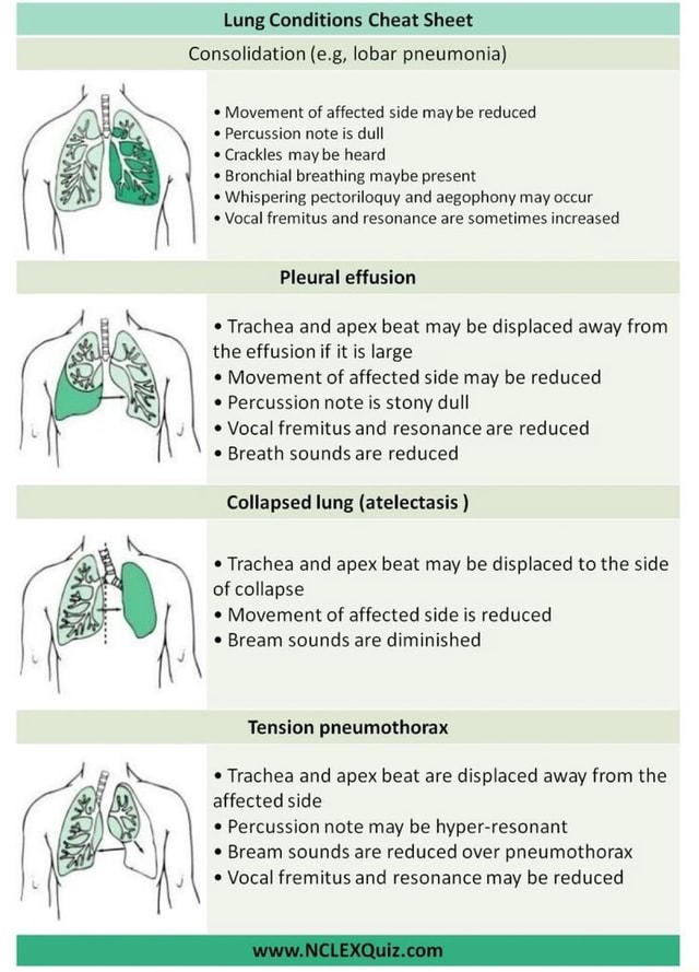 Lung Conditions Cheat Sheet Consolidation (e.g, lobar pneumonia ...