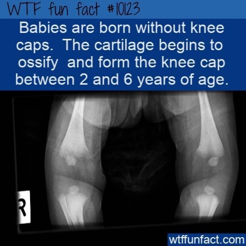 WTF fun fact 10123 Babies are born without knee caps The cartilage