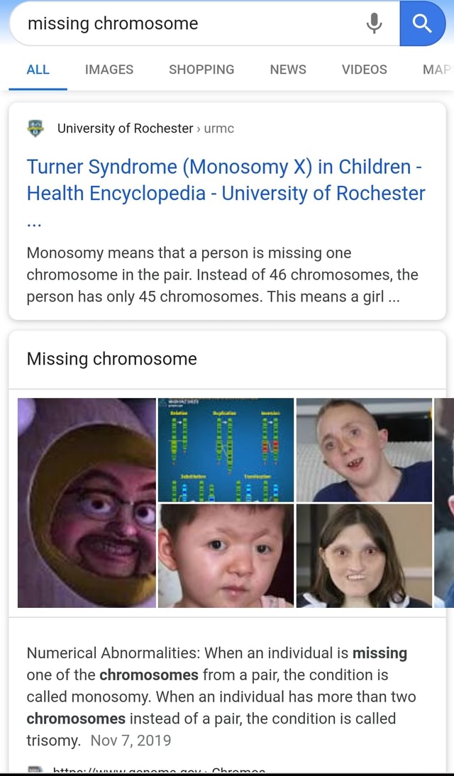 Missing chromosome 4 ALL IMAGES SHOPPING NEWS VIDEOS YY 3 University of