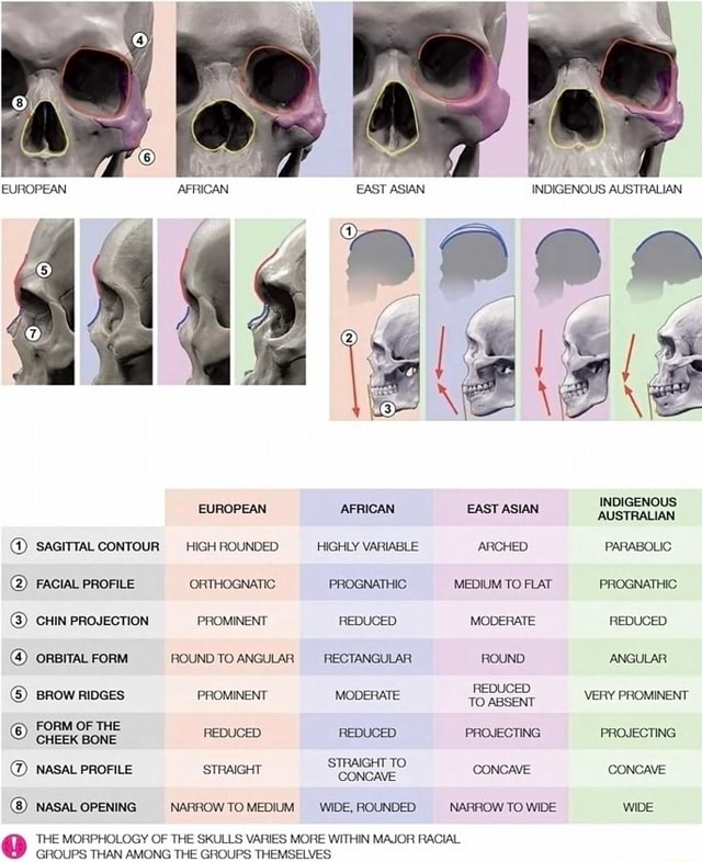EUROPEAN @ SAGITTAL CONTOUR HIGH ROUNDED FACIAL PROFILE ORTHOGNATIC ...