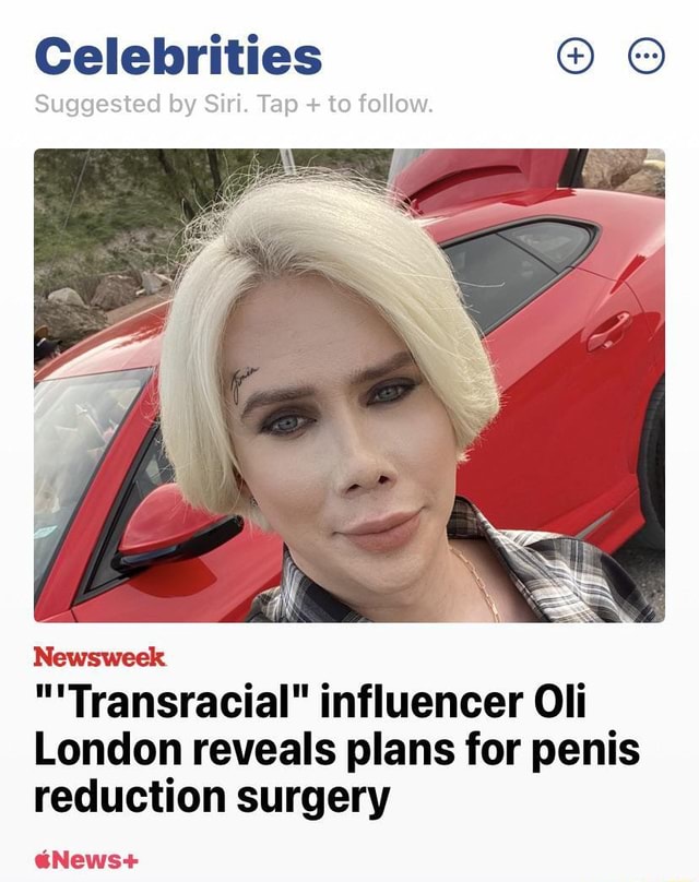 Transracial Influencer Reveals Plans For Penis Reduct 6285