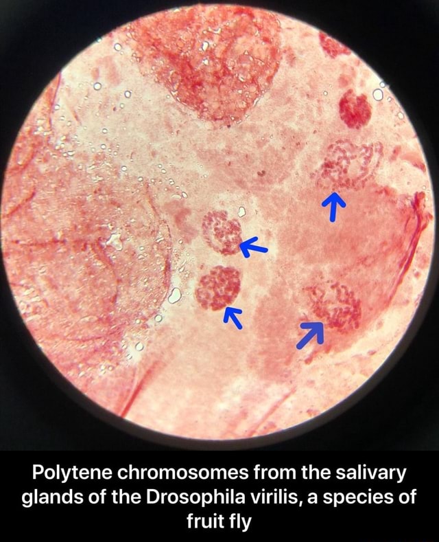 Polytene chromosomes from the salivary glands of the Drosophila virilis