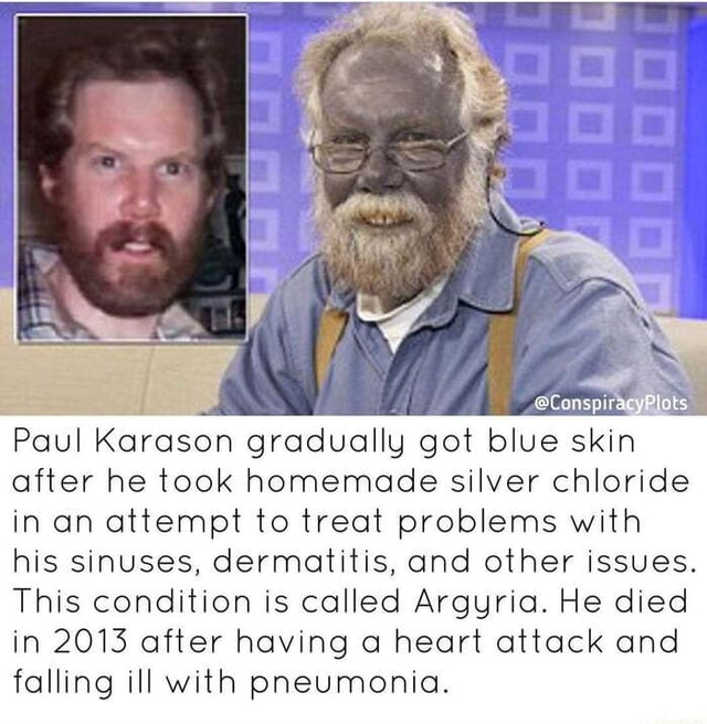 @ConspiracyPlats Paul Karason gradually got blue skin after he took ...