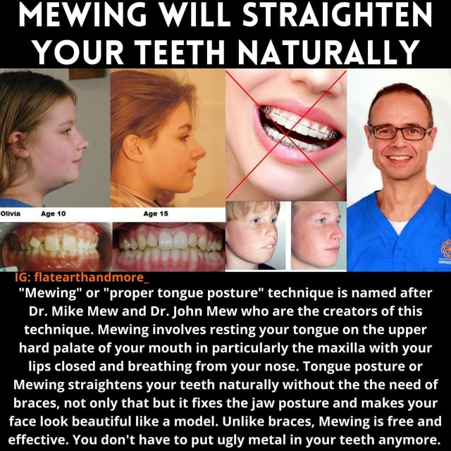 MEWING WILL STRAIGHTEN YOUR TEETH NATURALLY Olivia Aga flatearthandmore ...