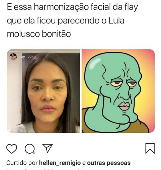 E essa harmonização facial da flay que ela ficou parecendo o Lula molusco bonitão Curtido por