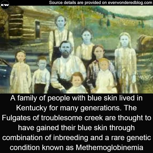 A Sal of people with blue skin lived in Kentucky for many generations ...