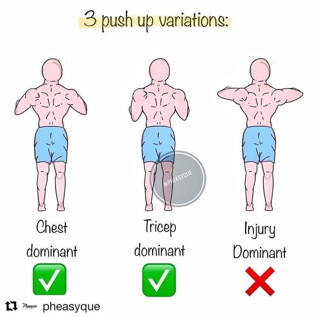 3 push up variations Chest Tricep Injury dominant dominant Dominant