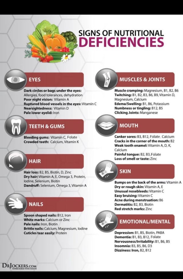 Dark circles or bags under the eyes Allergies, food tolerances