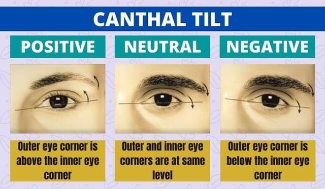 CANTHAL TILT POSITIVE NEUTRAL I I NEGATIVE I Outer eye corner is Outer ...