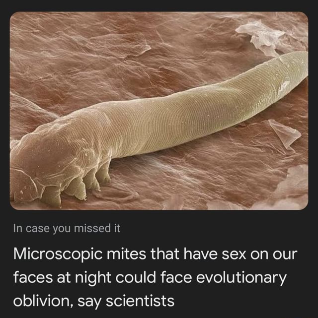 In Case You Missed It Microscopic Mites That Have Sex On Our Faces At 0255