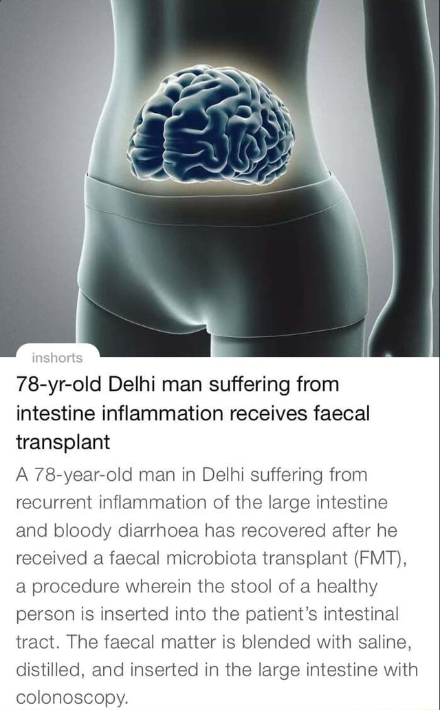 Inshorts 78yrold Delhi man suffering from intestine inflammation