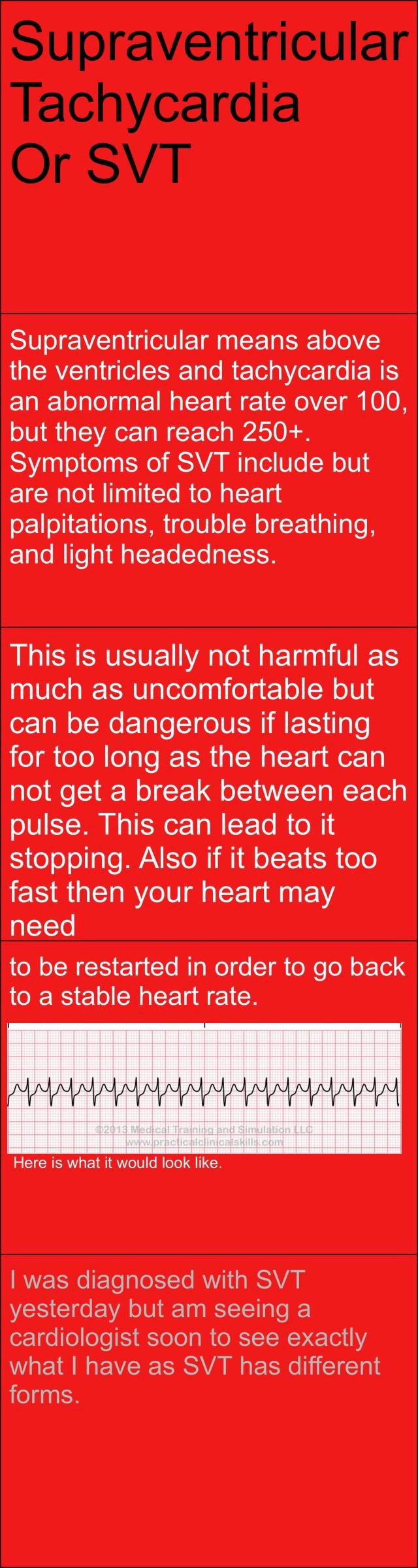 supraventricular-means-above-the-ventricles-and-tachycardia-is-an