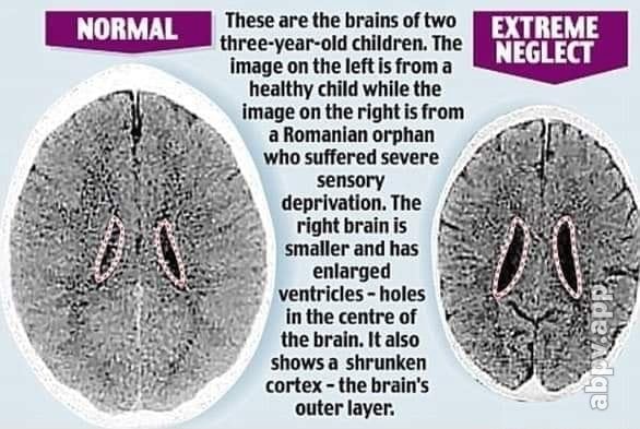 these-are-the-brains-of-two-three-year-old-children-the-image-on-the