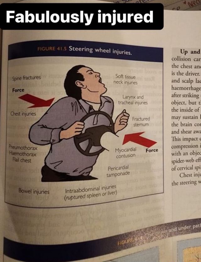 Fabulously injured Steering wheel injuries, Up and collision car the