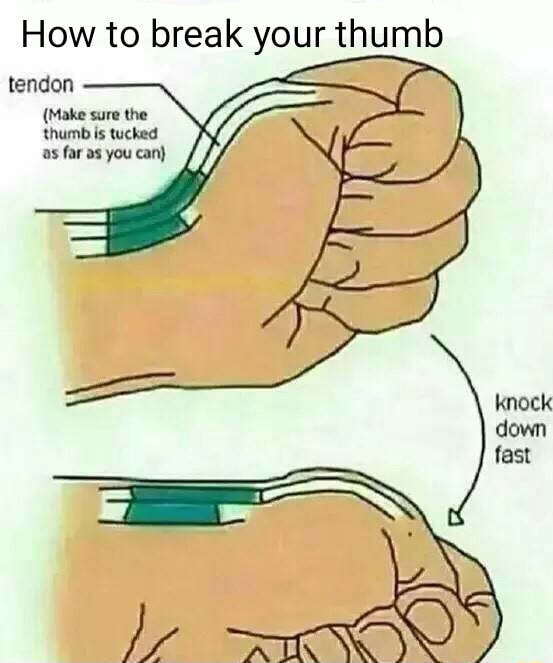 break your thumb easily