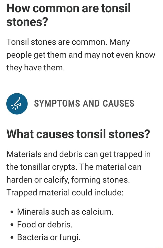 How common are tonsil stones? Tonsil stones are common. Many people get