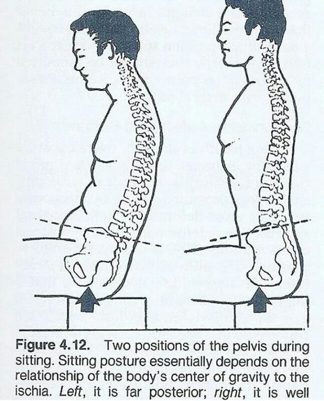 Figure 4.12. Two positions of the pelvis during sitting. Sitting ...