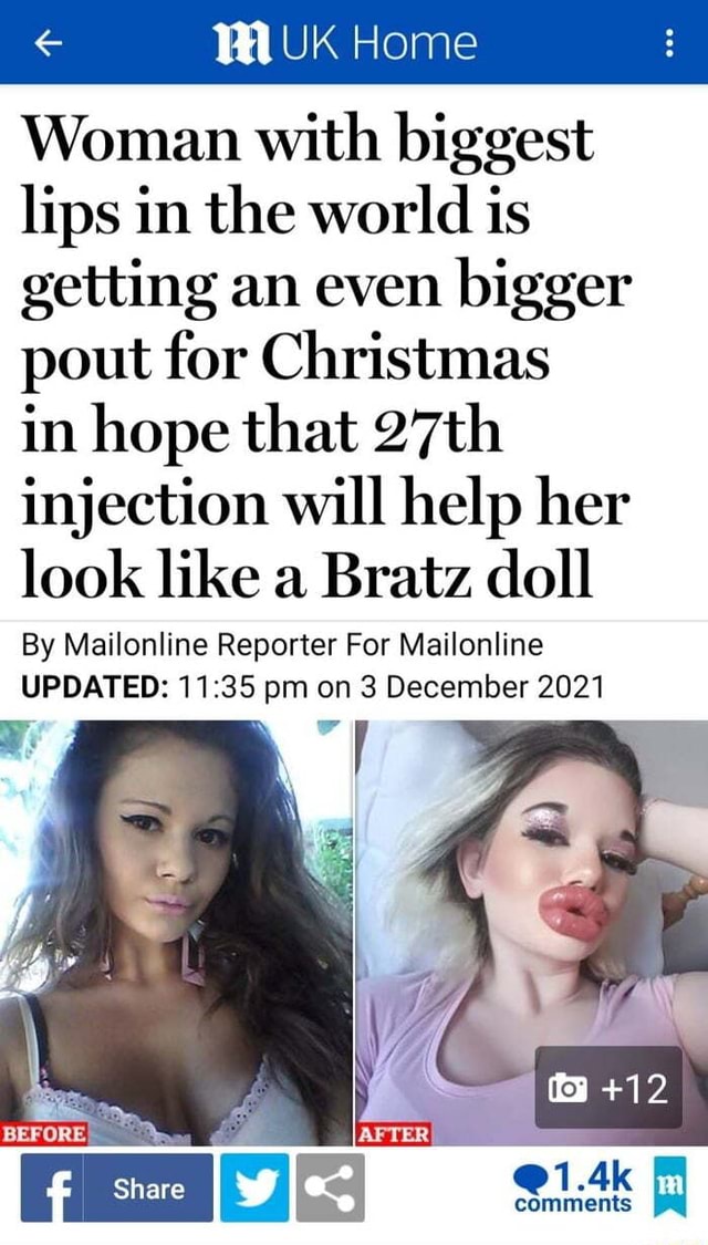 UK Home Woman With Biggest Lips In The World Is Getting An Even Bigger Pout For Christmas In