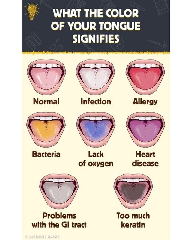 WHAT THE COLOR OF YOUR TONGUE SIGNIFIES Normal Infection Allergy ...