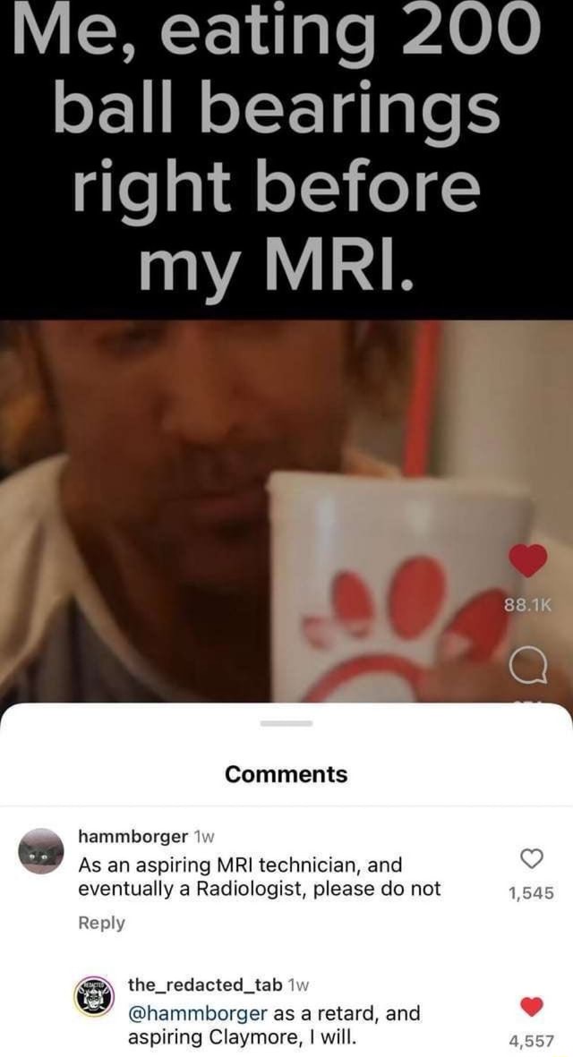 Me, eating 200 ball bearings right before my MRI. Comments