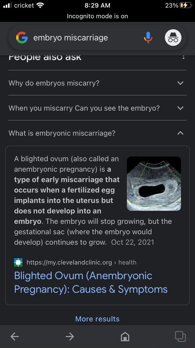 al-cricket-am-23-incognito-mode-is-on-g-embryo-miscarriage-reopie