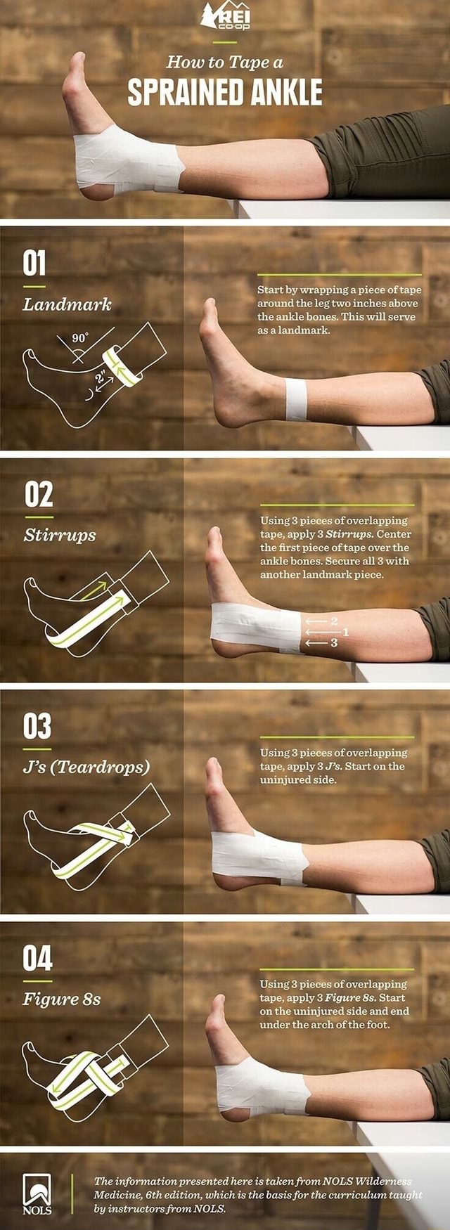 How to Tape SPRAINED ANKLE Landmark 02 Stirrups Start by wrapping a