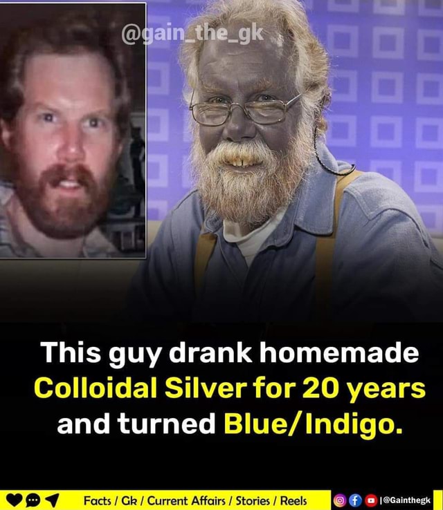 Yainthegk This Guy Drank Homemade Colloidal Silver For 20 Years And