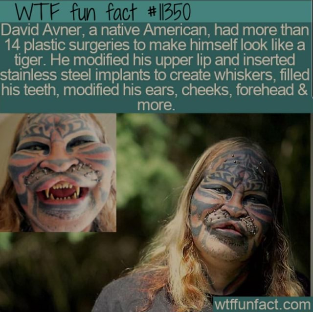 WTF fun fact David Avner, a native American, had more than 14 plastic ...