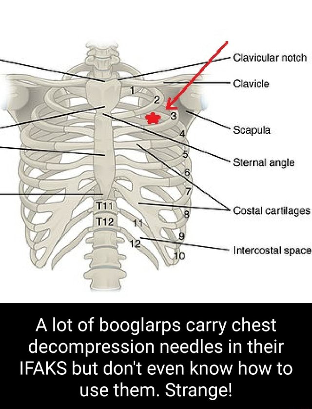 Clavicular notch Clavicle Scapula Siernal angle iTi2. 