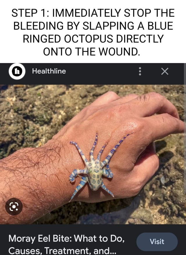 STEP 1 IMMEDIATELY STOP THE BLEEDING BY SLAPPING A BLUE RINGED OCTOPUS