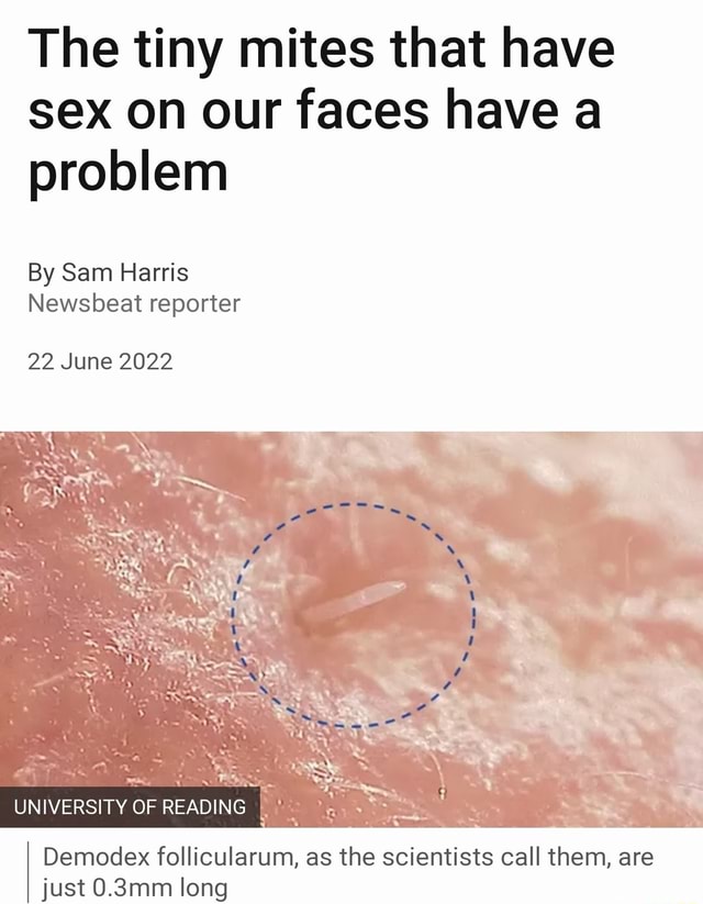 The Tiny Mites That Have Sex On Our Faces Have A Problem By Sam Harris Newsbeat Reporter 22 June 5271