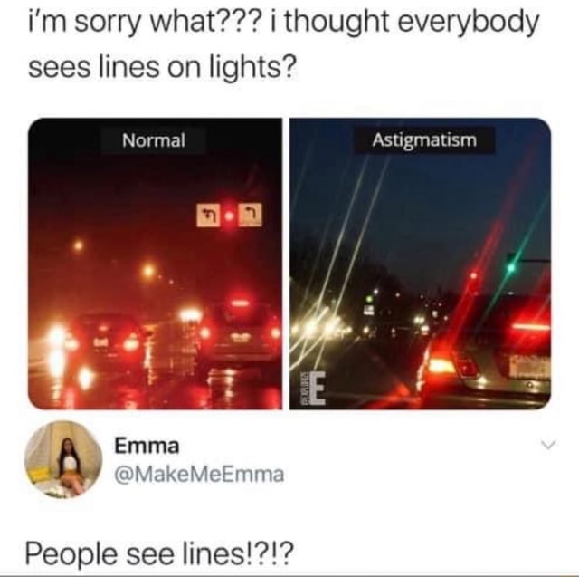 I'm sorry what??? i thought everybody sees lines on lights? People see