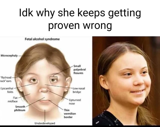 Idk why she keeps getting proven wrong Fetal alcohol syndrome - iFunny