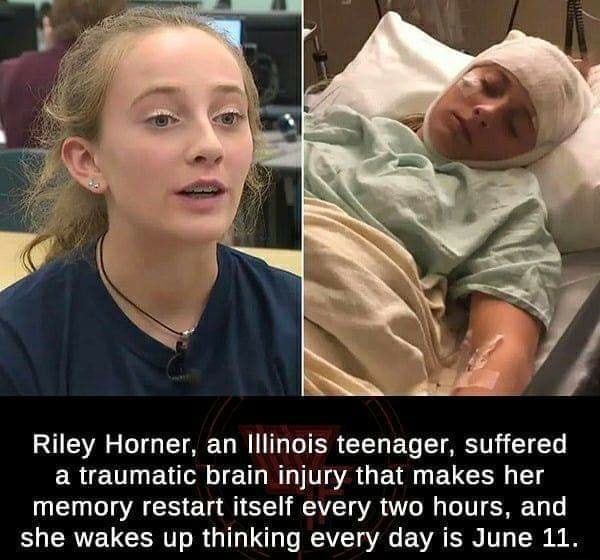 Riley Horner, an Illinois teenager, suffered a traumatic brain injury