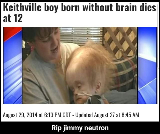 Keithville boy born without brain dies at 12