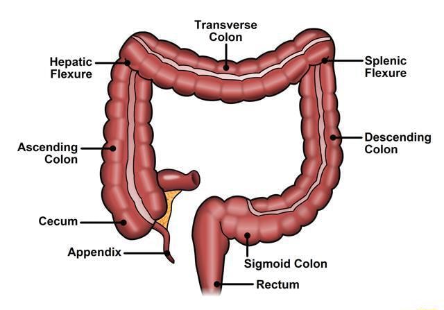 primary adenocarcinoma of descending colon and splenic flexure icd 10