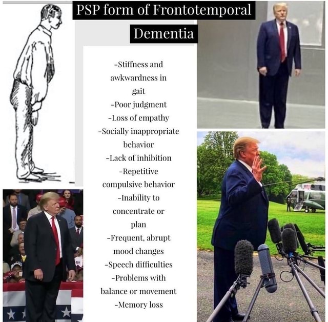 psp-form-of-frontotemporal-dementia-stiffness-and-awkwardness-in-gail