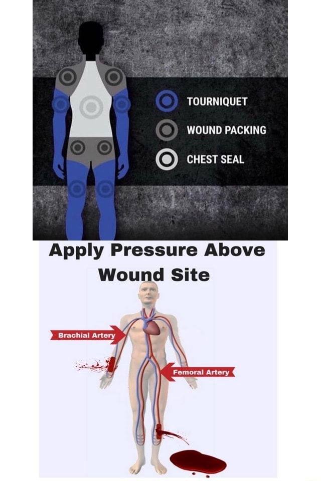 TOURNIQUET WOUND PACKING Apply Pressure Above Wound Site iFunny