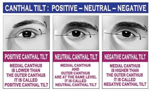 CANTHAL TILT POSITIVE NEUTRAL NEGATIVE POSITIVE CANTHAL TILT NEUTRAL   E0e5ab01965c5b5947b5fead34aebd579f4cd1928e99d2a6abd5bfd0cab16000 1 