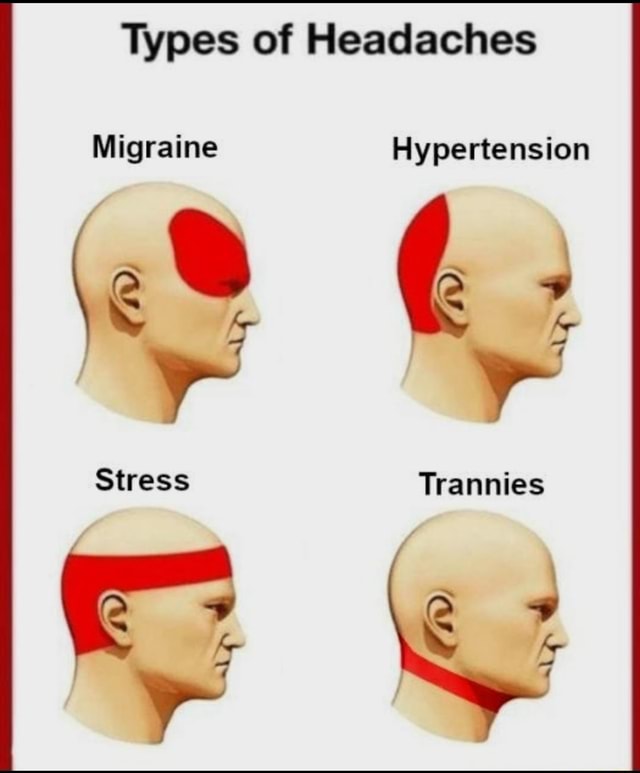 Types of Headaches Migraine Hypertension om~ Stress - iFunny