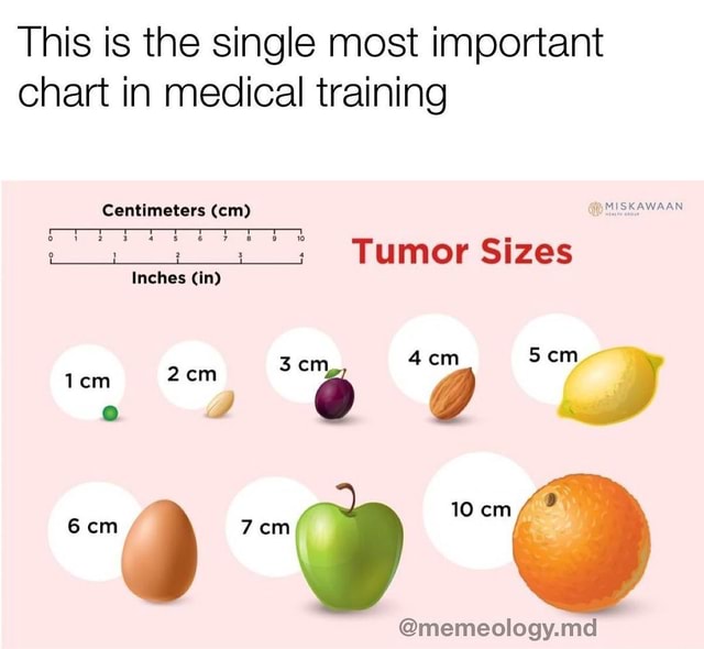 Second Opinion Said It Was Actually A Strawberry Sized Tumor This Is 