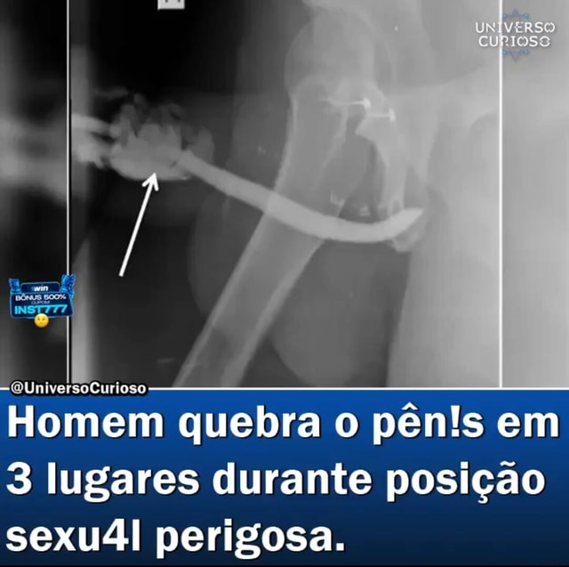 Universo Quniversocu Curioso Homem Quebra O Pêns Em Lugares Durante Posição Sexu4i Perigosa 7723